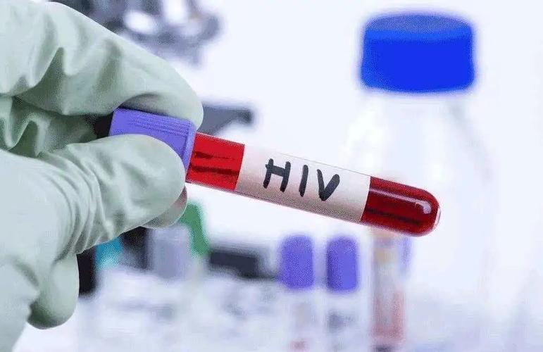 宁波艾滋病核酸检测